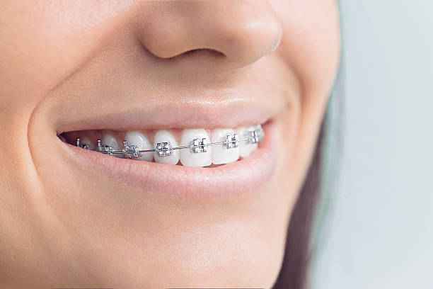 Best Invisalign and Clear Aligners  in Erath, LA